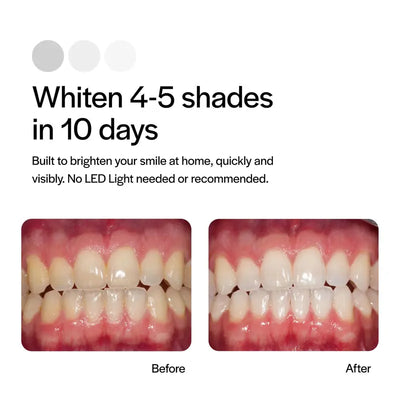 Opalescence Go 15% Hydrogen Peroxide Teeth Whitening Bundle - (7 Treatments) Prefilled Whitening Trays & Travel Sensitive Whitening Toothpaste 1 Oz - Mint