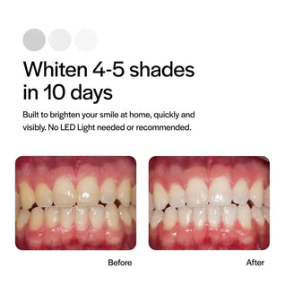 Opalescence Go 15% Hydrogen Peroxide Teeth Whitening Bundle - (7 Treatments) Prefilled Whitening Trays & Travel Sensitive Whitening Toothpaste 1 Oz - Mint